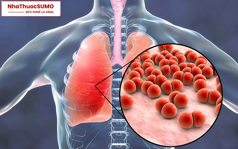 Nếu muốn đề phòng viêm phổi cũng như các bệnh hô hấp không lây nhiễm thì có thể sử dụng Bluemoxi