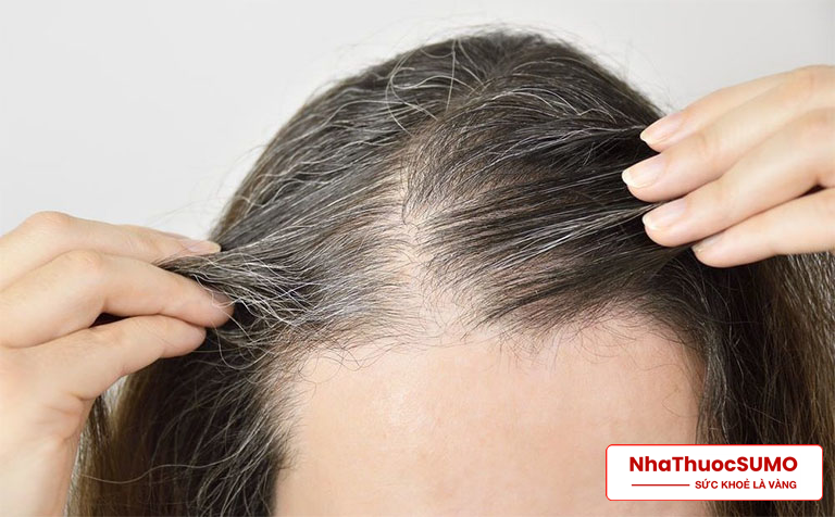 Ngăn ngừa rụng tóc là công dụng quan trọng của Bonihair