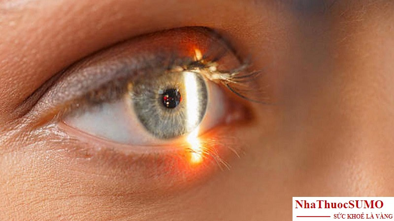Võng mạc mắt là phần rất dễ bị tổn thương