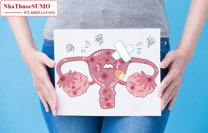Những lý do cơ bản khiến cơ thể bị đa nang buồng trứng