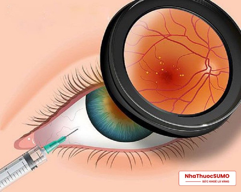 Quá trình lão hóa điểm vàng trong mắt sẽ được làm chậm rất nhiều