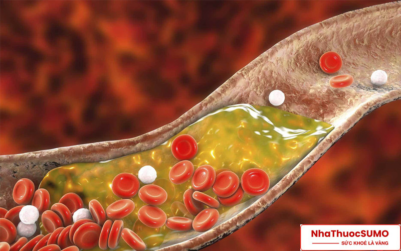 Các thành phần trong thuốc Dynamogen giúp giảm cholesterol hiệu quả