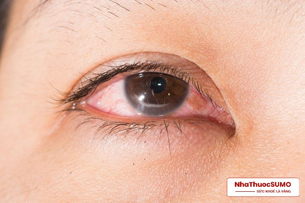 Một số bệnh lý điển hình của mắt sẽ được hỗ trợ điều trị