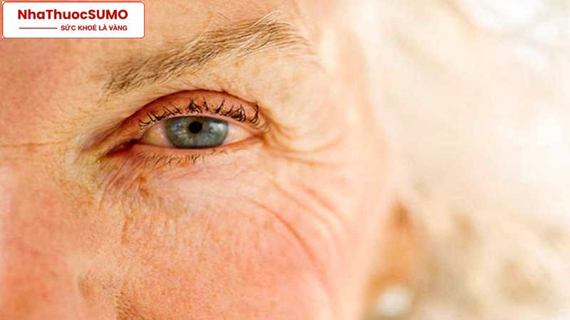 Khi già sẽ dễ bị thoái hoá điểm vàng ở mắt nên sử dụng Ubiheal 200 có thể cải thiện rõ rệt